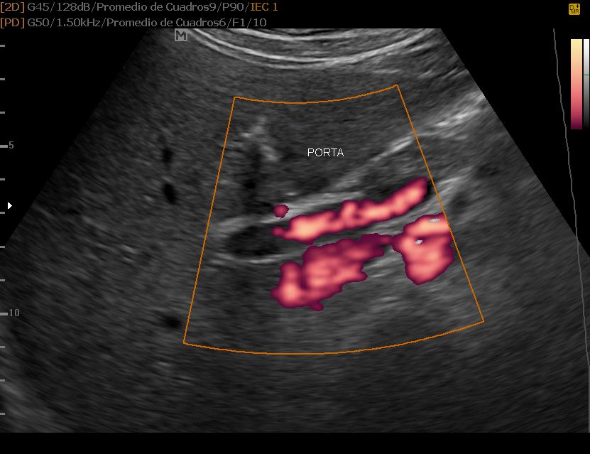 Doppler Ultrasonido 3d Y 5d Hd Live Doppler Y Biopsias 