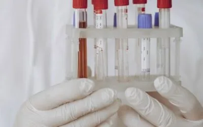 Biometría Hemática