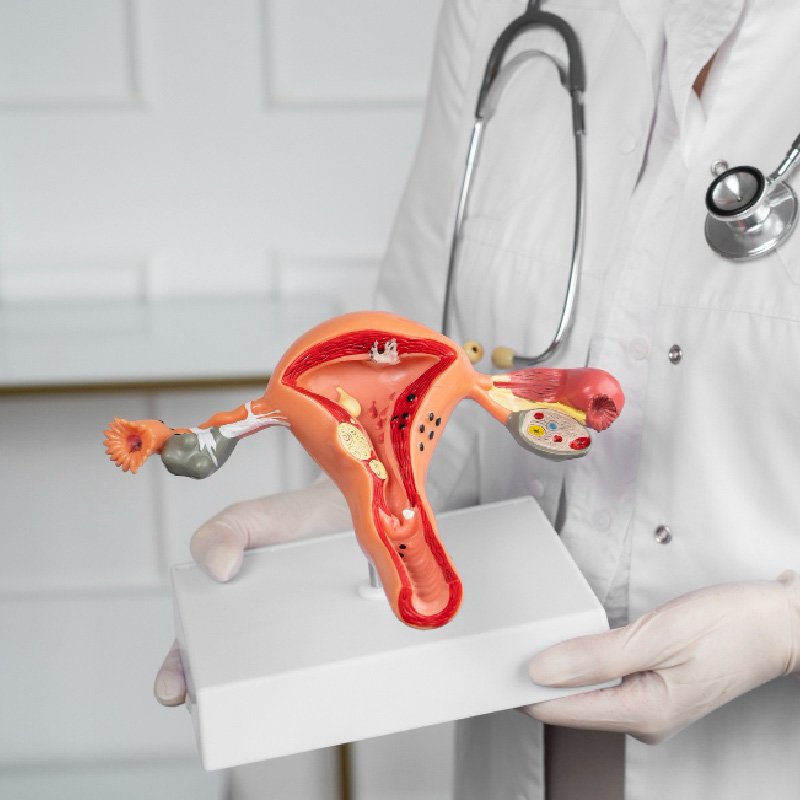 Histero-salpingografía