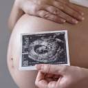 IMAGENES_ULTRASONIDO_OBSTETRICO